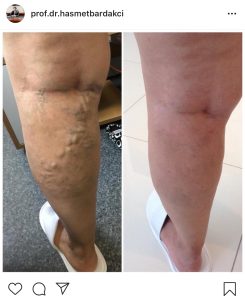 Varis (Sosyal Medya) (11)