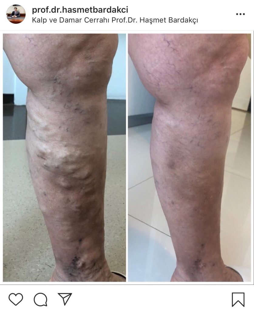 Varis (Sosyal Medya) (21)