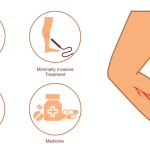 Varis Tedavisi Ağrılı mı?